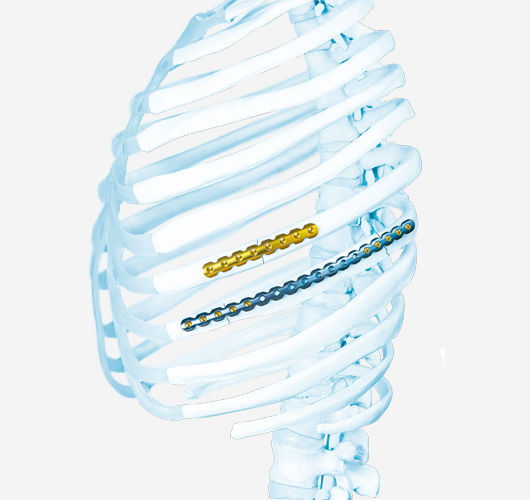 生物型全髋关节
