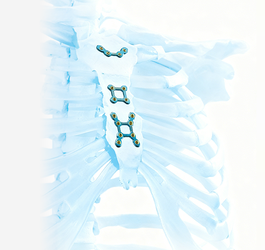 生物型全髋关节